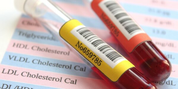 Image representing GET YOUR TEST RESULTS